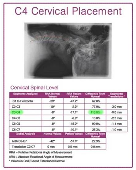 cervical c4